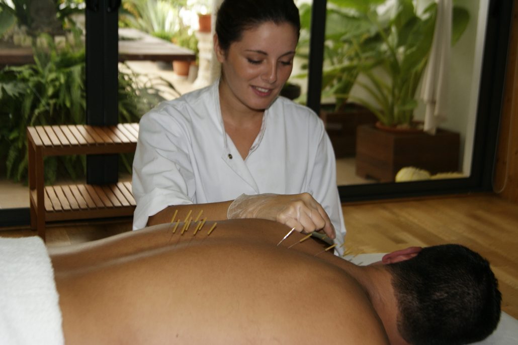 Expertos en Acupuntura - Sant Cugat